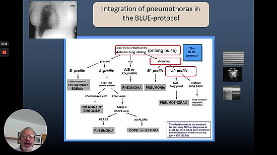 6.5. BLUE-protocol & pneumothorax